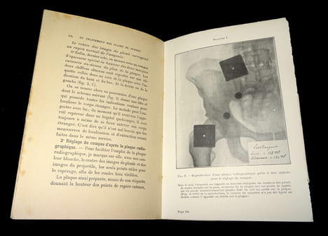 INDICATIONS GÉNÉRALES DU TRAITEMENT DES PLAIES DE GUERRE
suivies de quelques médications à l'usage des blessés, la localisation des corps étrangers, ...