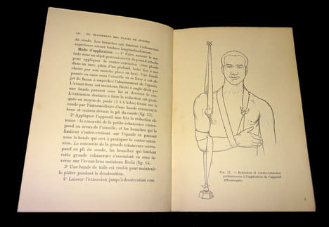 INDICATIONS GÉNÉRALES DU TRAITEMENT DES PLAIES DE GUERRE
suivies de quelques médications à l'usage des blessés, la localisation des corps étrangers, ...