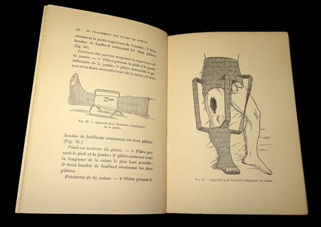 INDICATIONS GÉNÉRALES DU TRAITEMENT DES PLAIES DE GUERRE
suivies de quelques médications à l'usage des blessés, la localisation des corps étrangers, ...