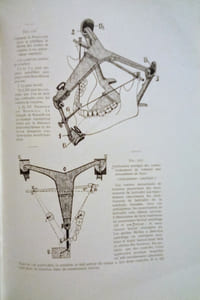 Dentures et Dentiers complets.