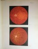 Fundus Oculi Diagnostica Oftalmoscopica del Prof. Quirino di Marzio (Direttore R. Clinica Oculistica di Bologna).. MARZIO (Prof. Quirino di)